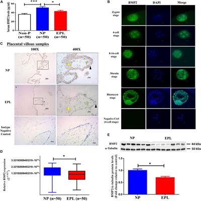 The BMP2 Signaling Axis Promotes Invasive Differentiation of Human Trophoblasts